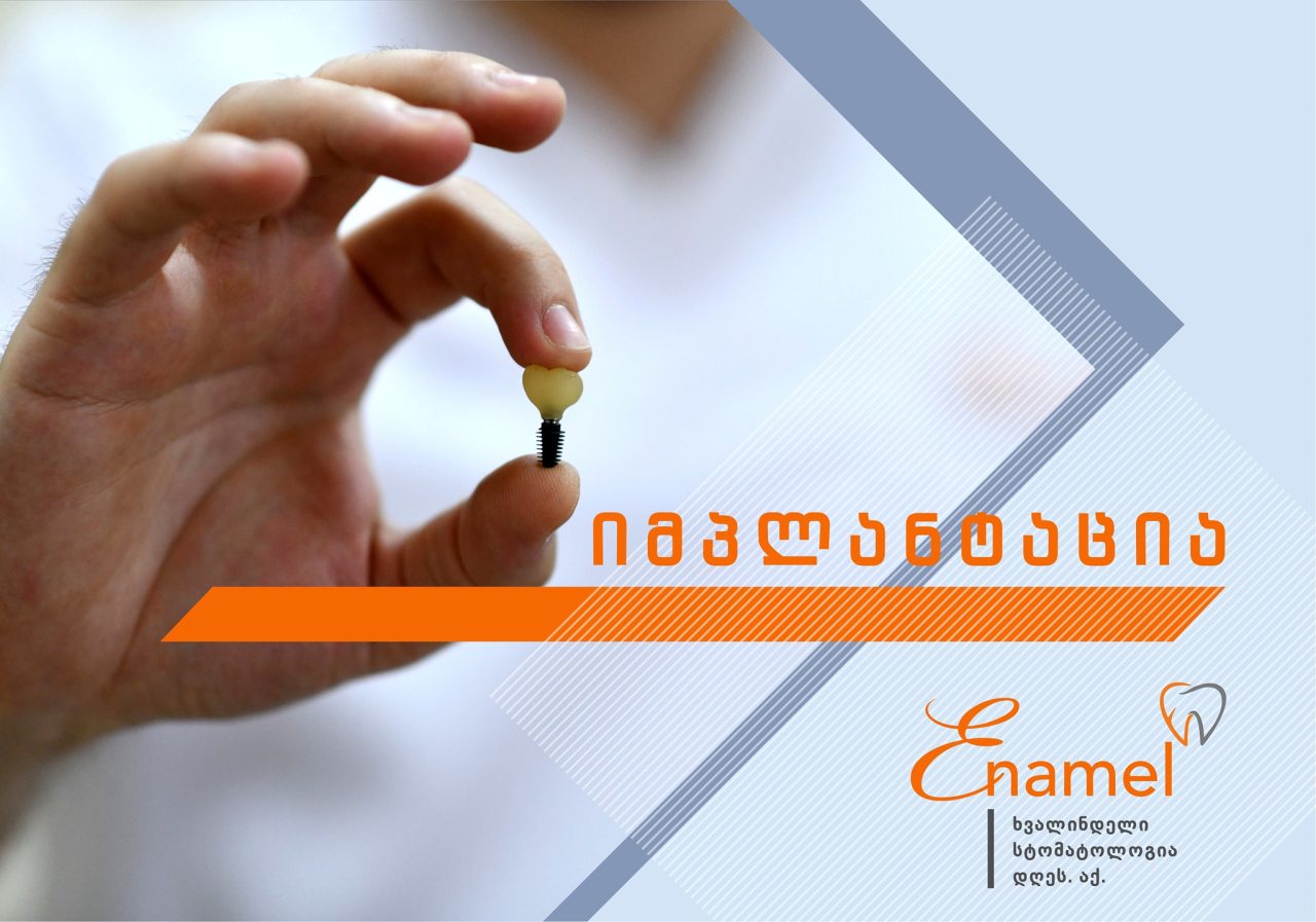 https://enameldentistry.ge/wp-content/uploads/2021/12/217686305_1154379661749868_7196204279898920369_n-1280x897.jpg